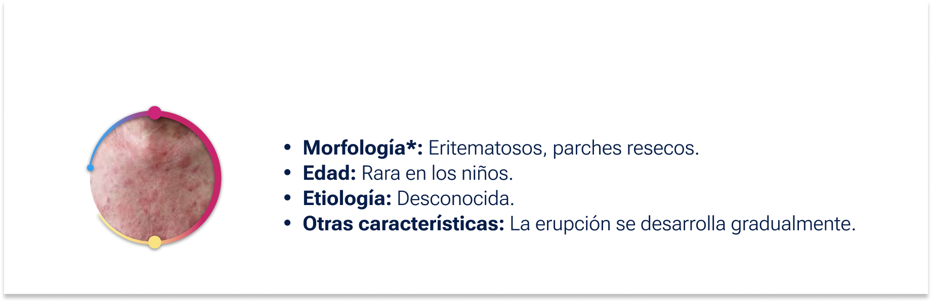 Linfoma cutáneo de células T